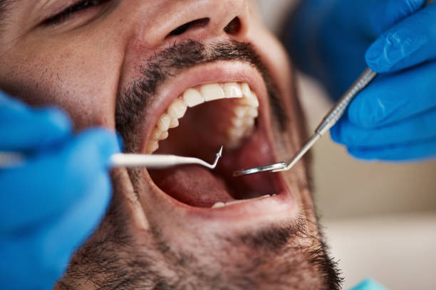 Best Emergency Dental Care for Trauma or Injury in Keuka Park, NY