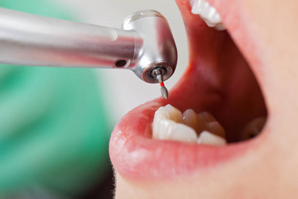 Best Emergency Broken Tooth Repair in Keuka Park, NY